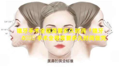 镶牙手术全程需要多久时间「镶牙 🐕 手术全程需要多久时间做完 🐕 」